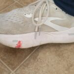 Blood on shoes